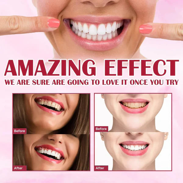 Yayashi SP4 Probiotic Whitening Toothpaste