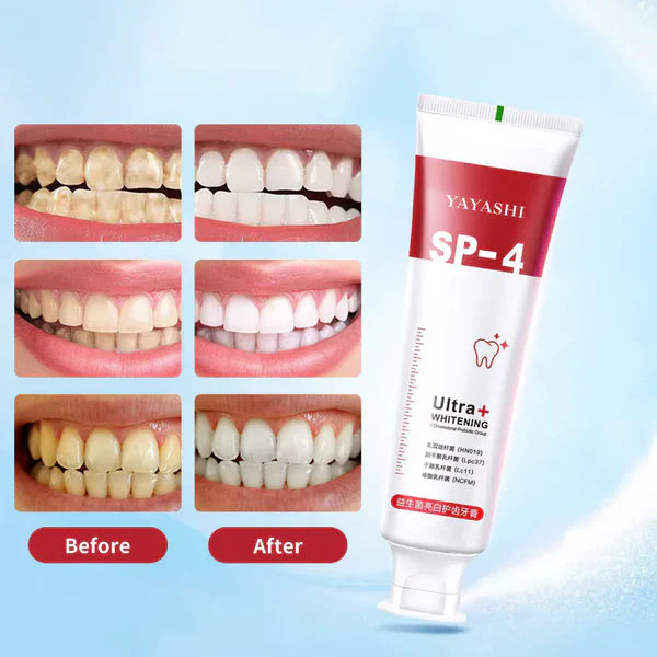 Yayashi SP4 Probiotic Whitening Toothpaste