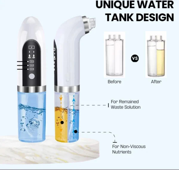 Bubble Facial & Blackhead Remover – Deep Cleanser for Glowing Skin